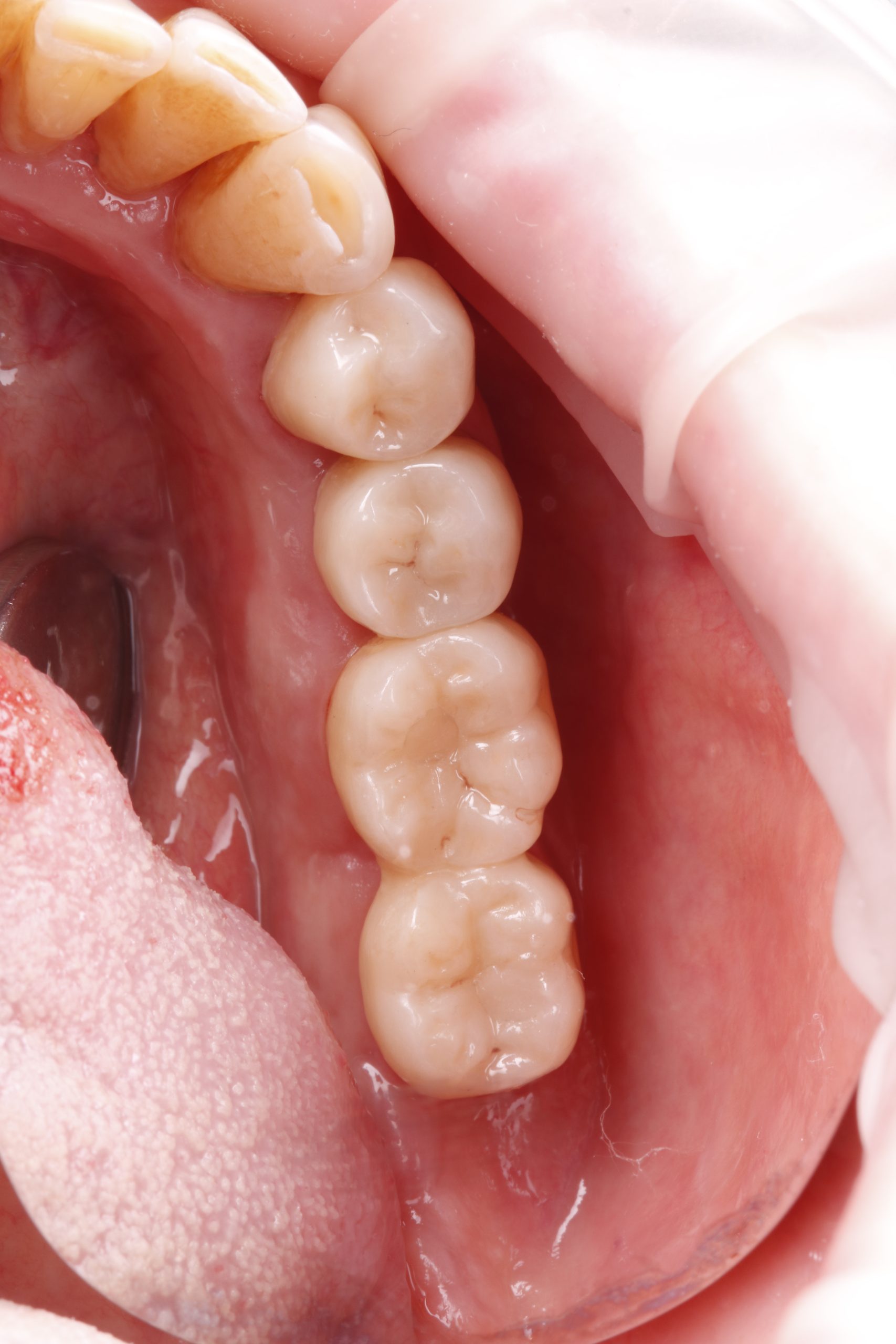 9-1 после (1) 9-1 после (1)